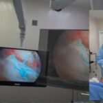 Surgeon Uses Apple Vision Pro Technology in Amazing Footage of Shoulder Surgery